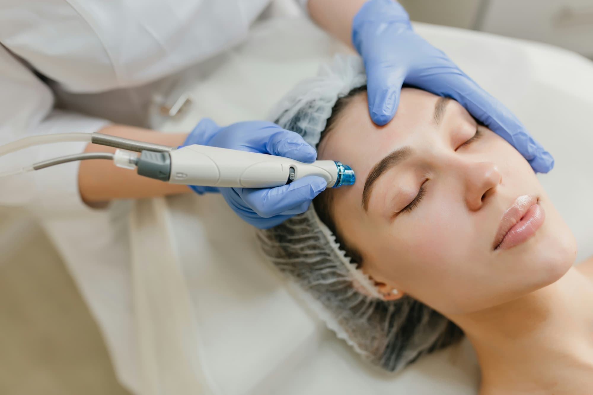 Laser Treatments